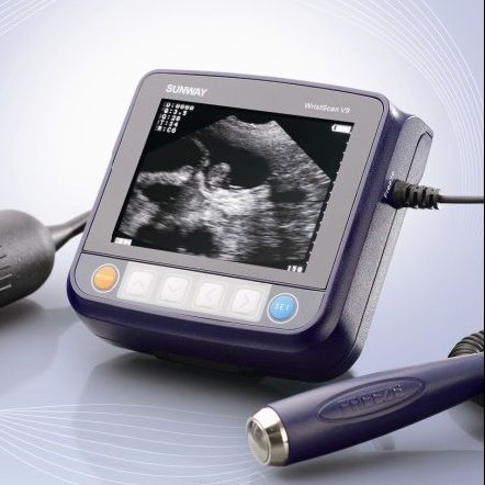 Переносной ветеринарный эхограф - Wristscan V9 - Sunway Medical - для крупных животных