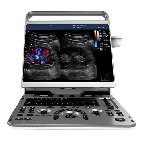 Ветеринарный эхограф переносной, с тележкой - EBit 50  - Chison Medical Imaging - для крупного рогатого скота / для лошади / для овец