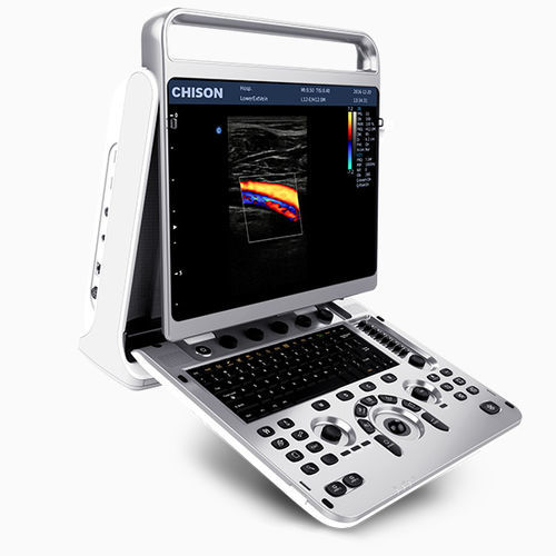 Переносной ветеринарный эхограф - EBit 20 - Chison Medical Imaging - для овец / для собак / для лошадей