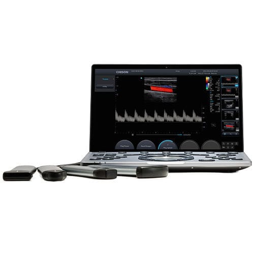 Переносной ветеринарный эхограф - SonoAir 60 - Chison Medical Imaging - для крупных животных / для сельскохозяйственных животных / линейный