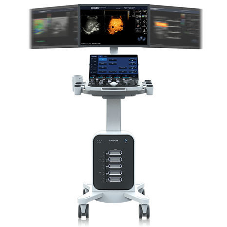Ветеринарный эхограф для крупного рогатого скота - SonoMax 7 - Chison Medical Imaging - переносной, с тележкой / линейный / для абдоминальной визуализации